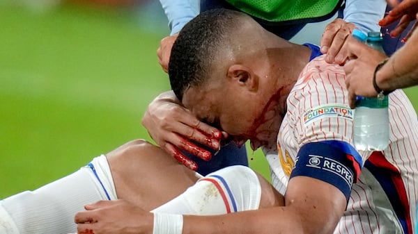 La France gagnante malgré le nez cassé de Mbappé